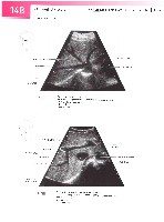 Sobotta  Atlas of Human Anatomy  Trunk, Viscera,Lower Limb Volume2 2006, page 155